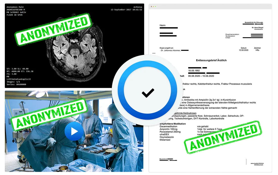 Automatically anonymized – ready to share